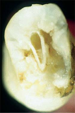 10398035_812211535500227_4661018509111500693_n