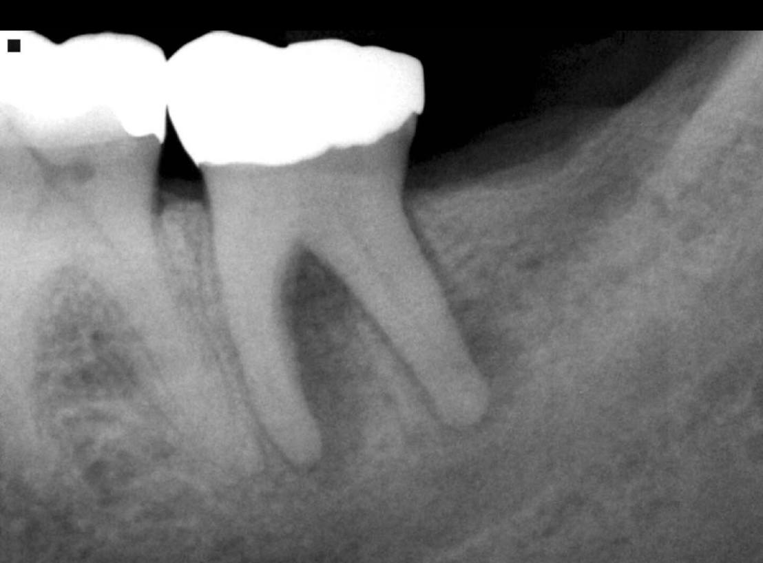 10682173_832332613488119_5444099016203292329_o