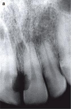 11012409_812207822167265_2142092912146321145_n