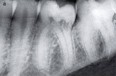 11113879_812209535500427_6002034229819047015_n