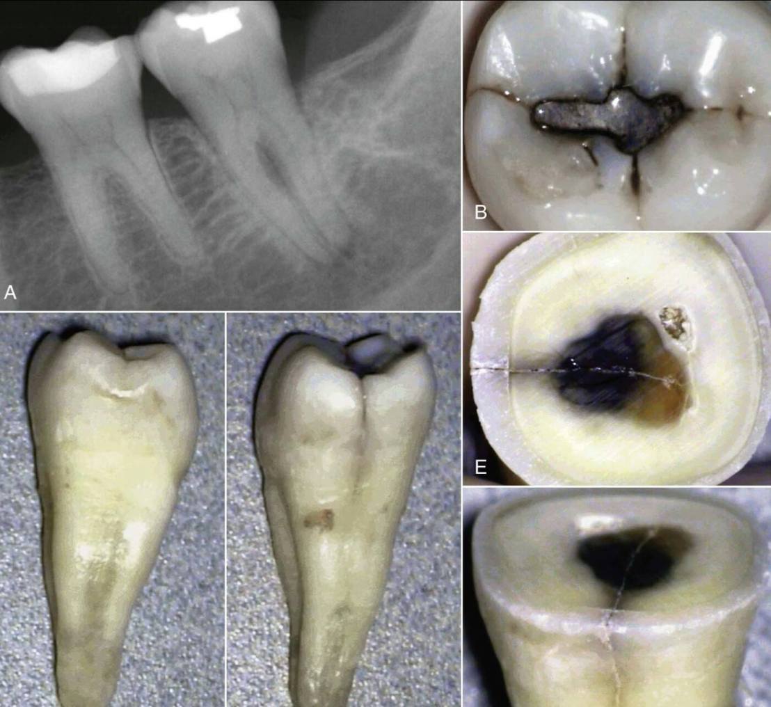 11357081_832323226822391_8097463193684206960_o