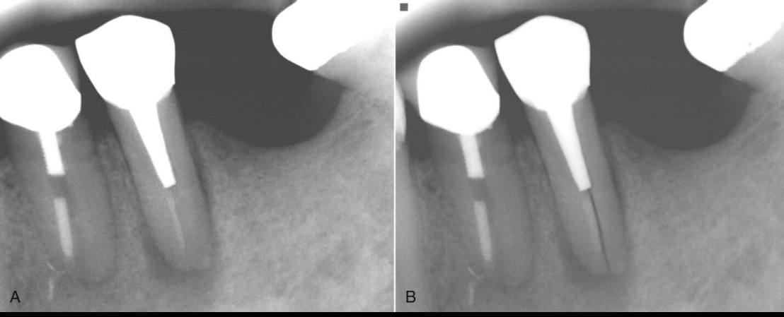 11698782_832340783487302_2770192851910890807_o