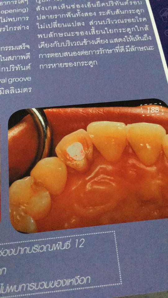 13528664_1014240875297291_8413318987846105122_n