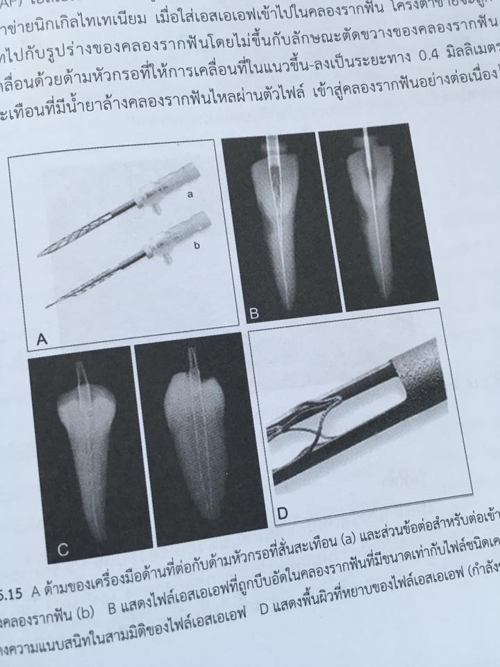 14732350_1115202831867761_2425881172961549591_n