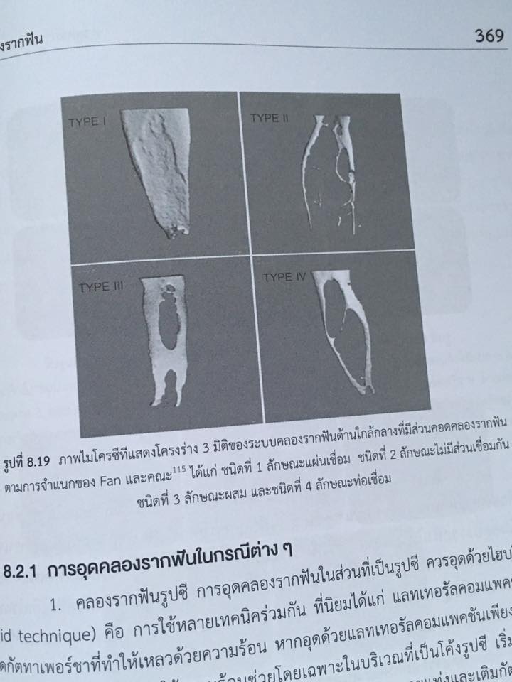 15037173_1115211215200256_1477775137864633534_n