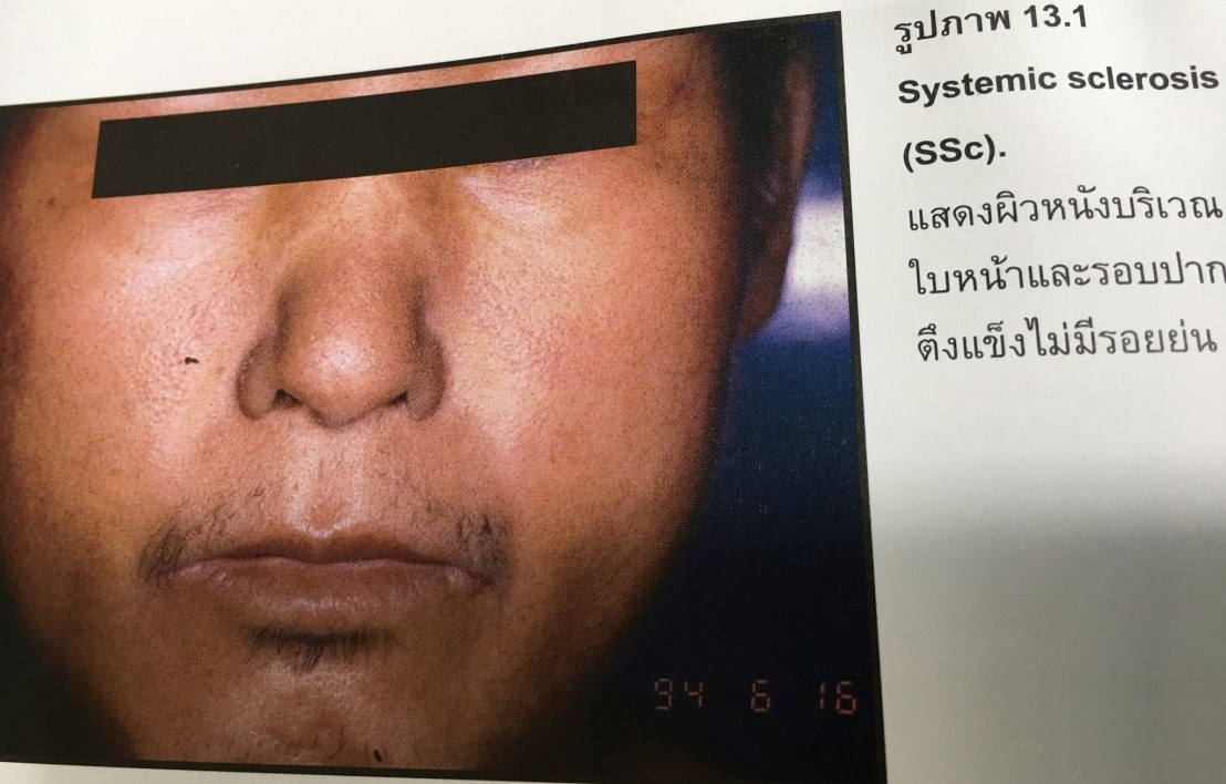 18839544_1737937166220692_7023200580270983323_o