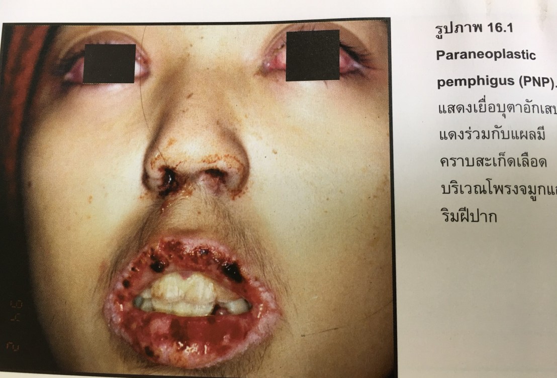 19800660_1737939996220409_9152231110689706769_o