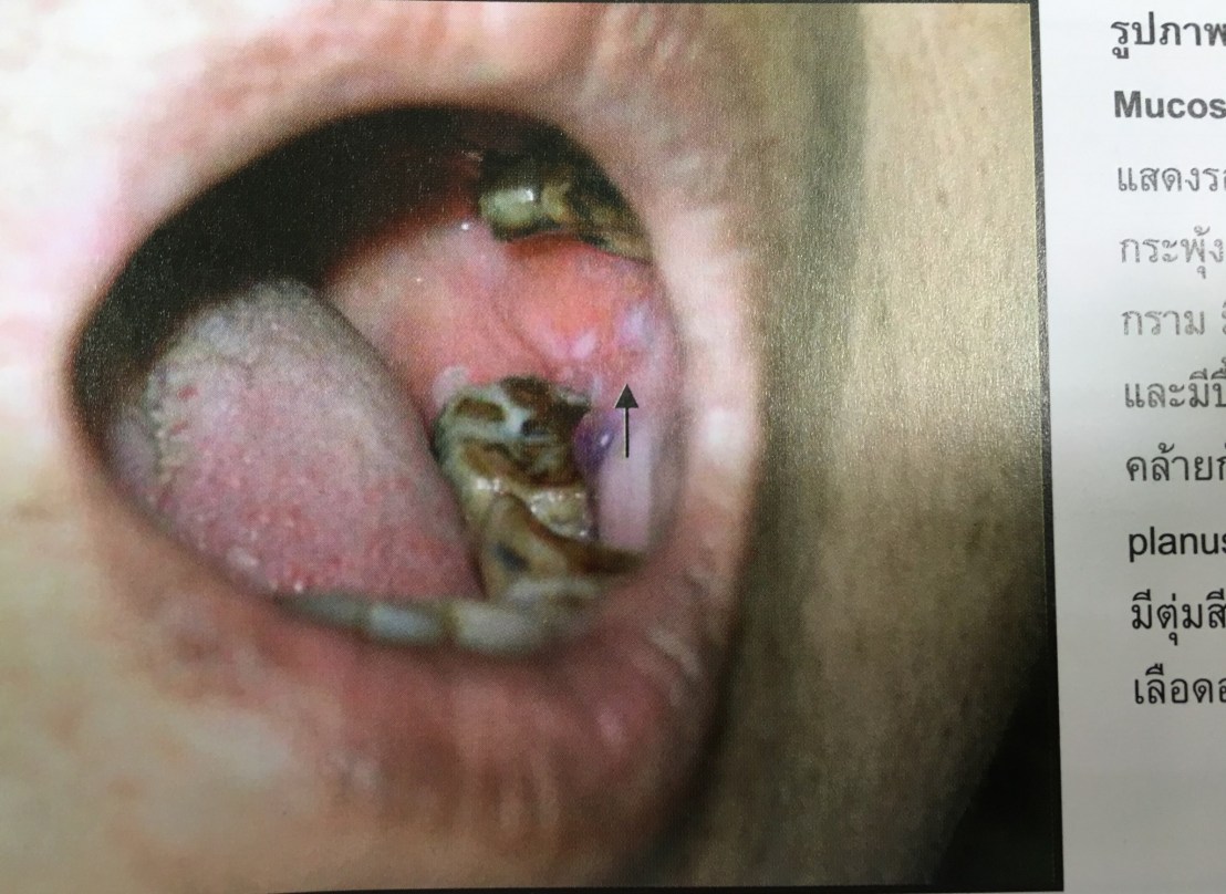 19800926_1737936432887432_7728125113446762531_o