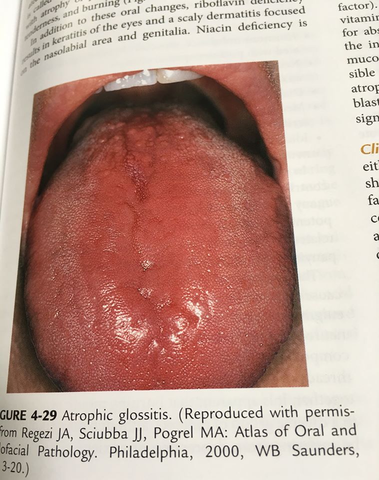 19894928_1737929916221417_1631441986043774485_n