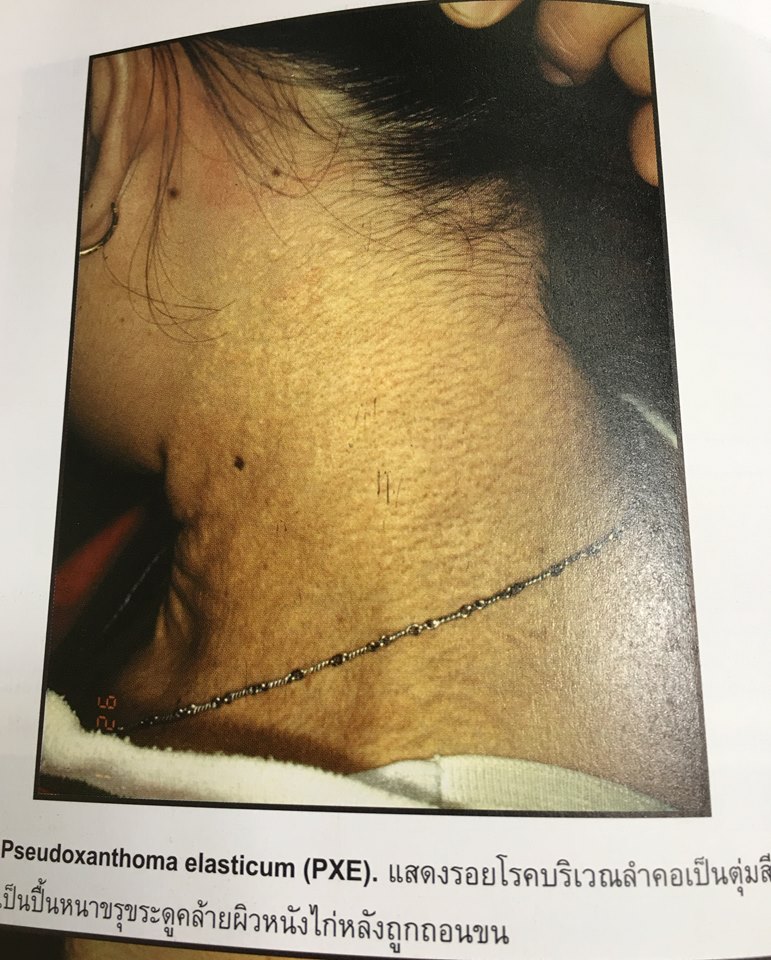 19895082_1737935039554238_2230159496674370094_n