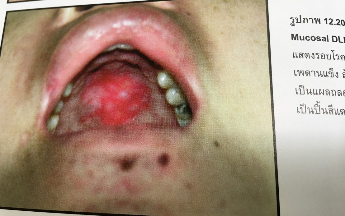 19944640_1737936542887421_5215499437420623251_o