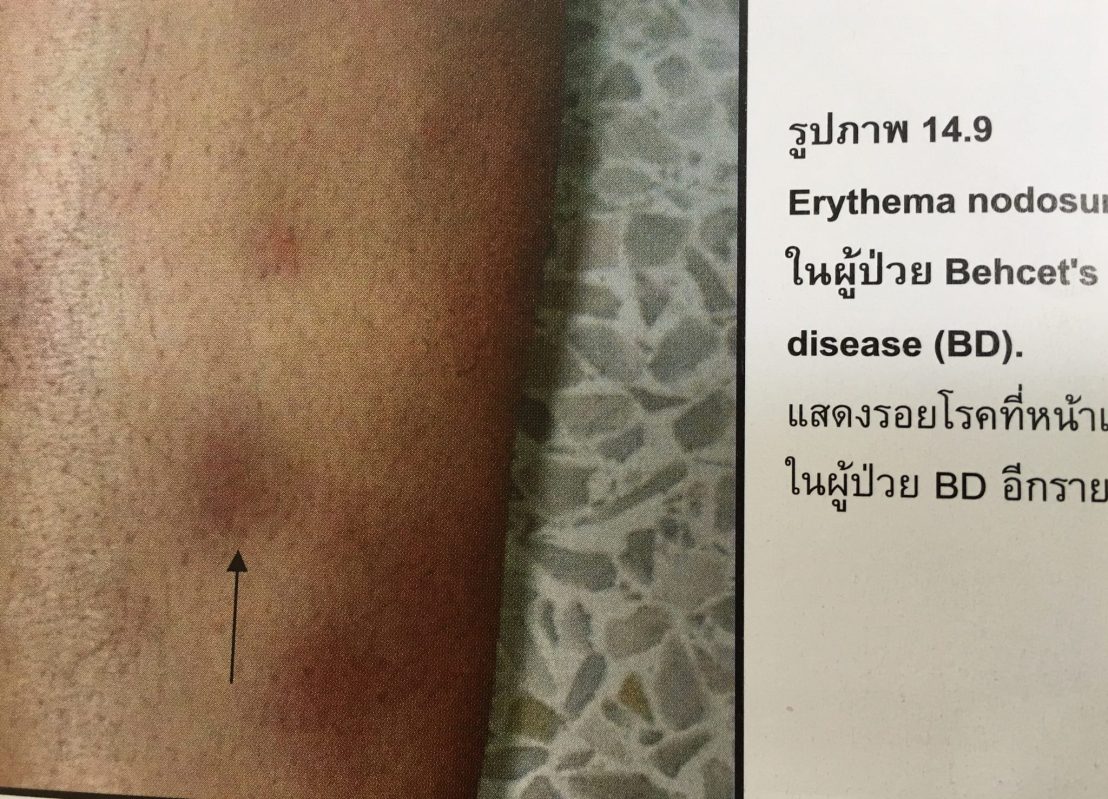 19956196_1737938889553853_1222489033365803157_o