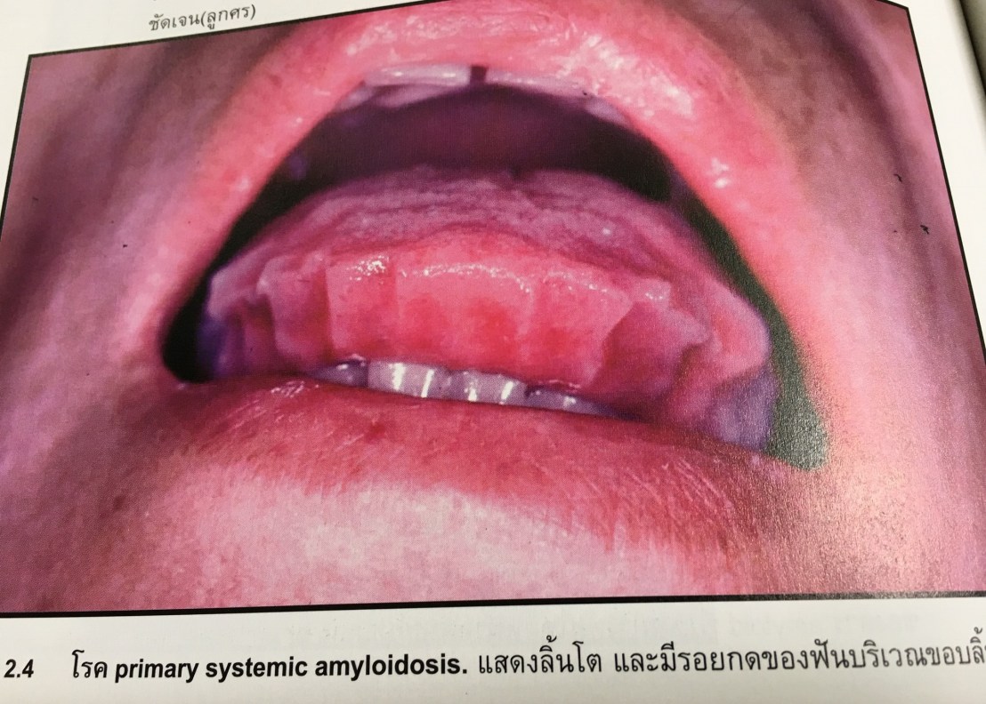 19956585_1737930259554716_6476591050235360504_o