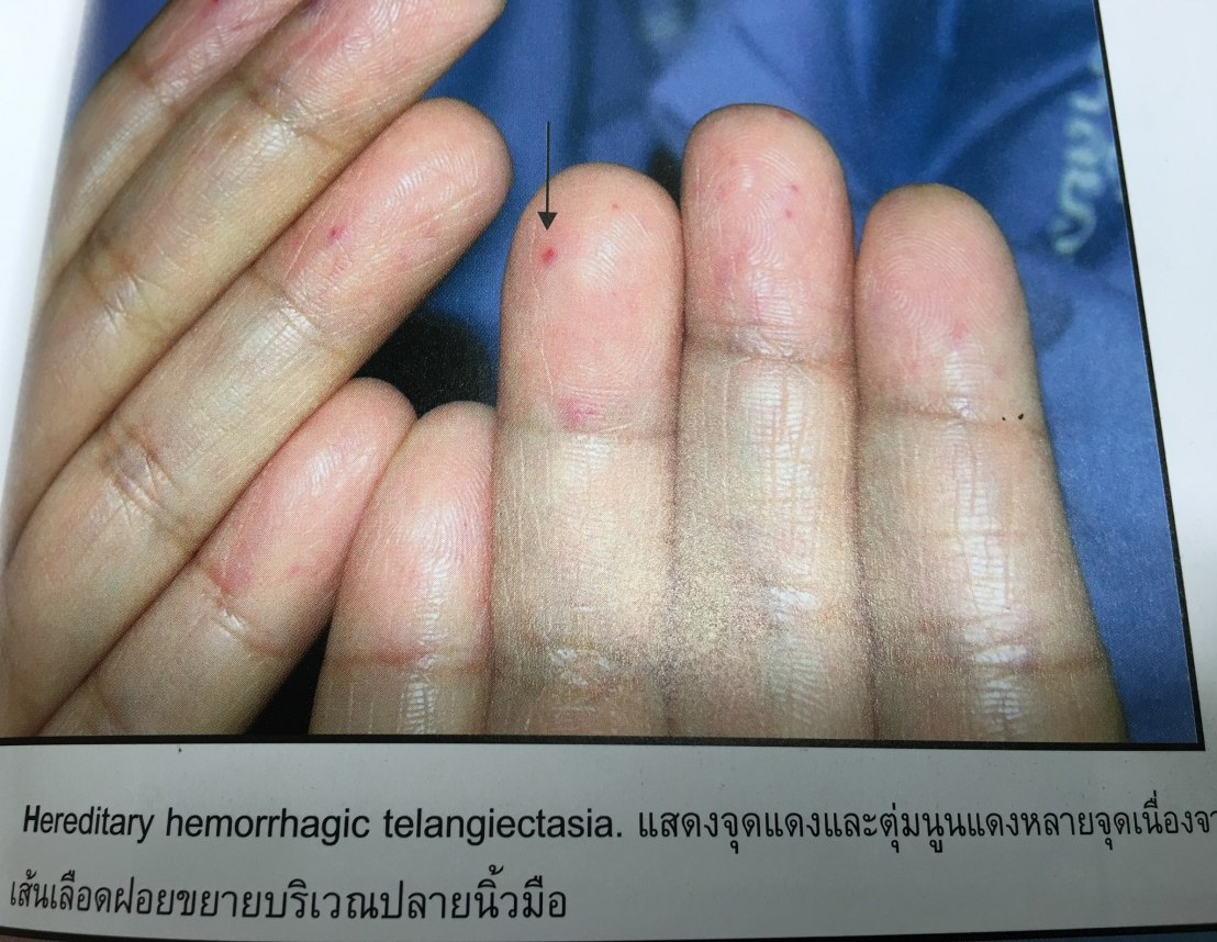 19956590_1737934852887590_64047022312909083_o