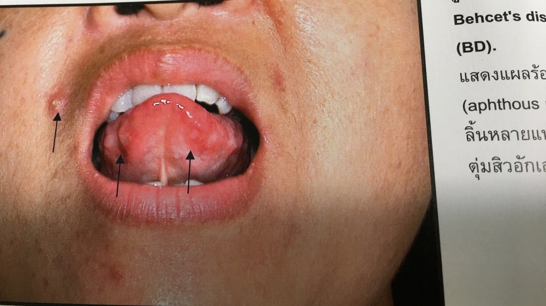 19956640_1737937779553964_4294919622725192496_o