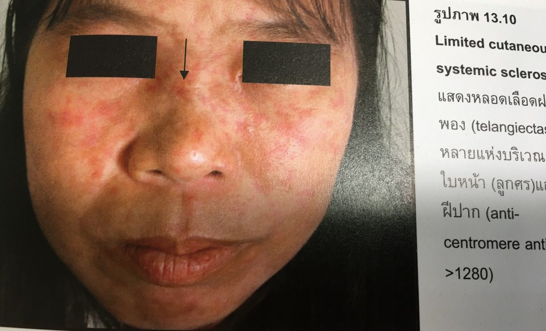 19956726_1737937296220679_3342394282171204529_o