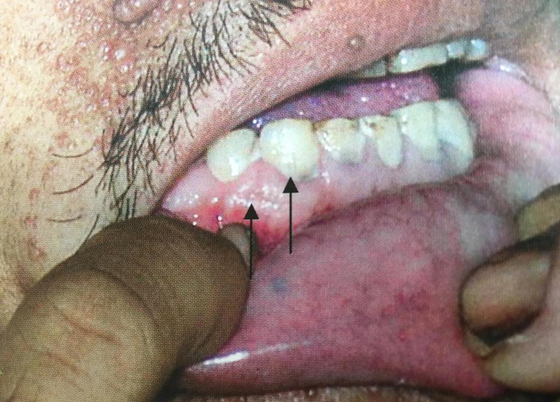 19956742_1737935632887512_6110210990538891788_o