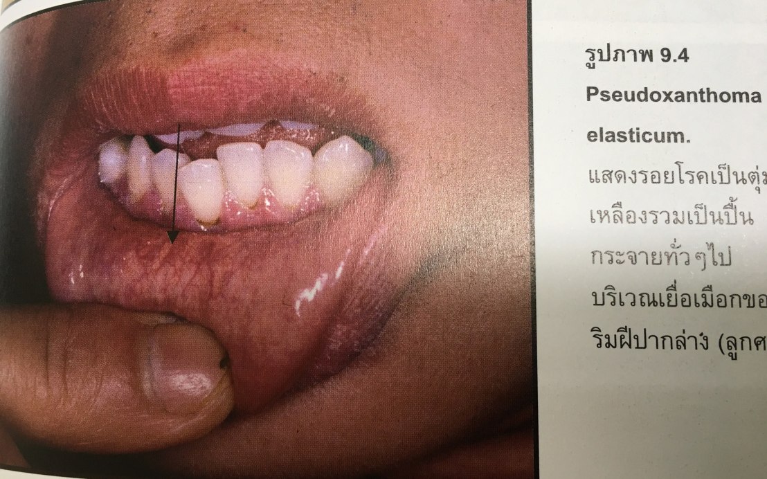 19956848_1737935112887564_7007519409581003062_o