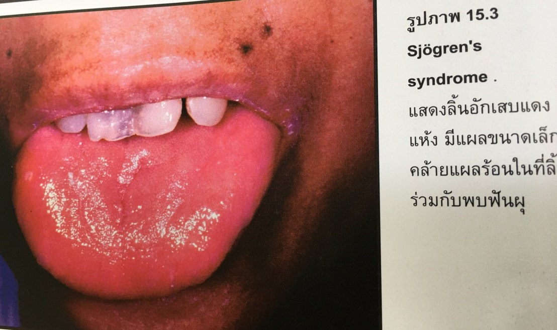 19956974_1737938976220511_5764444248721748485_o