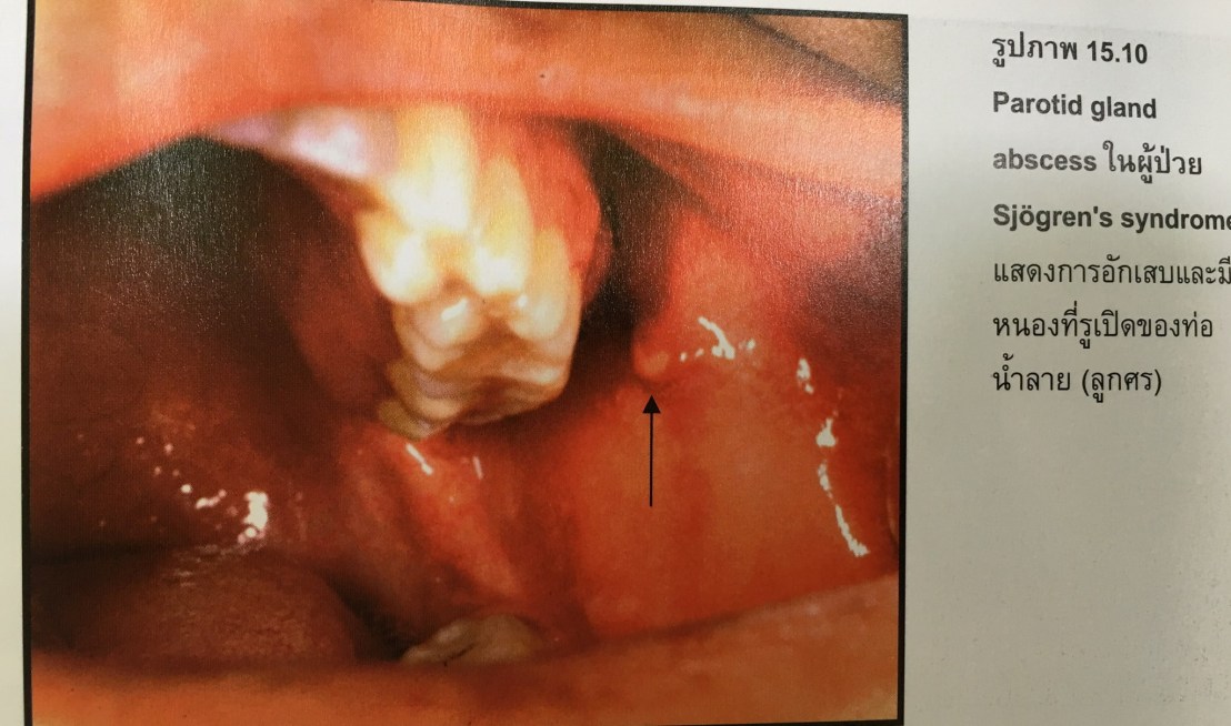 19956996_1737939432887132_1339532701057682222_o