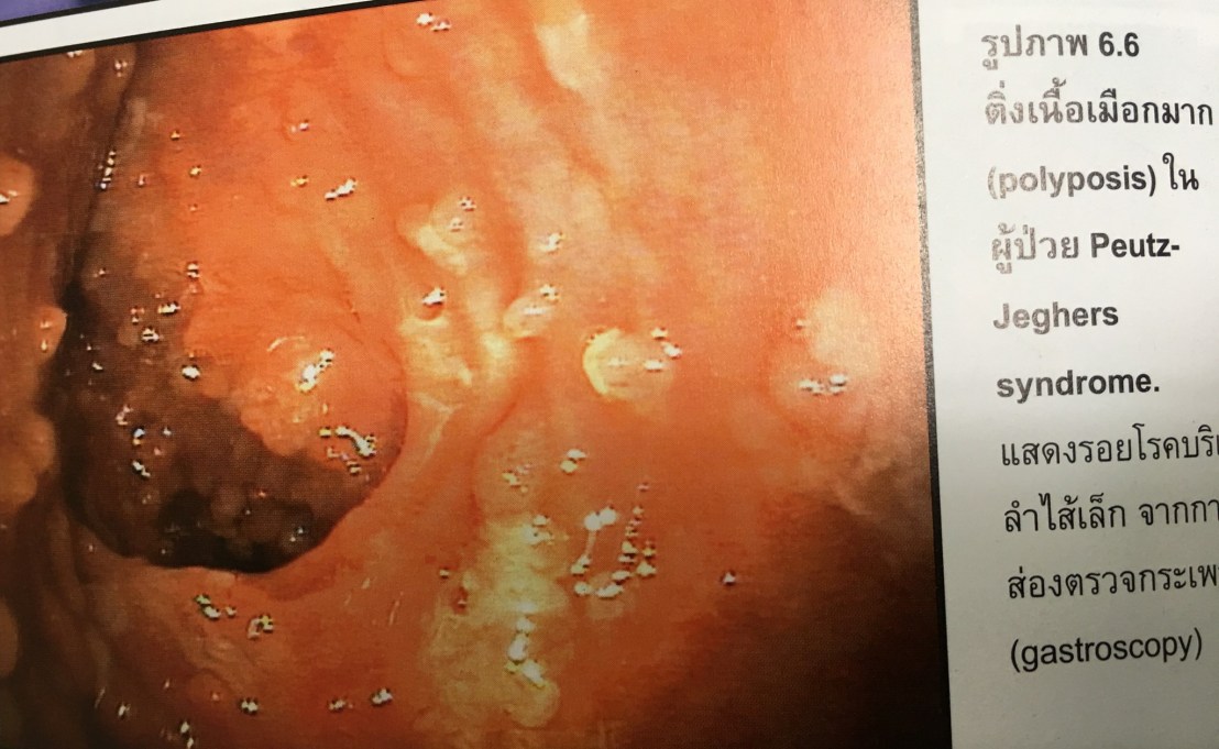 19957038_1737933376221071_728701285436106404_o