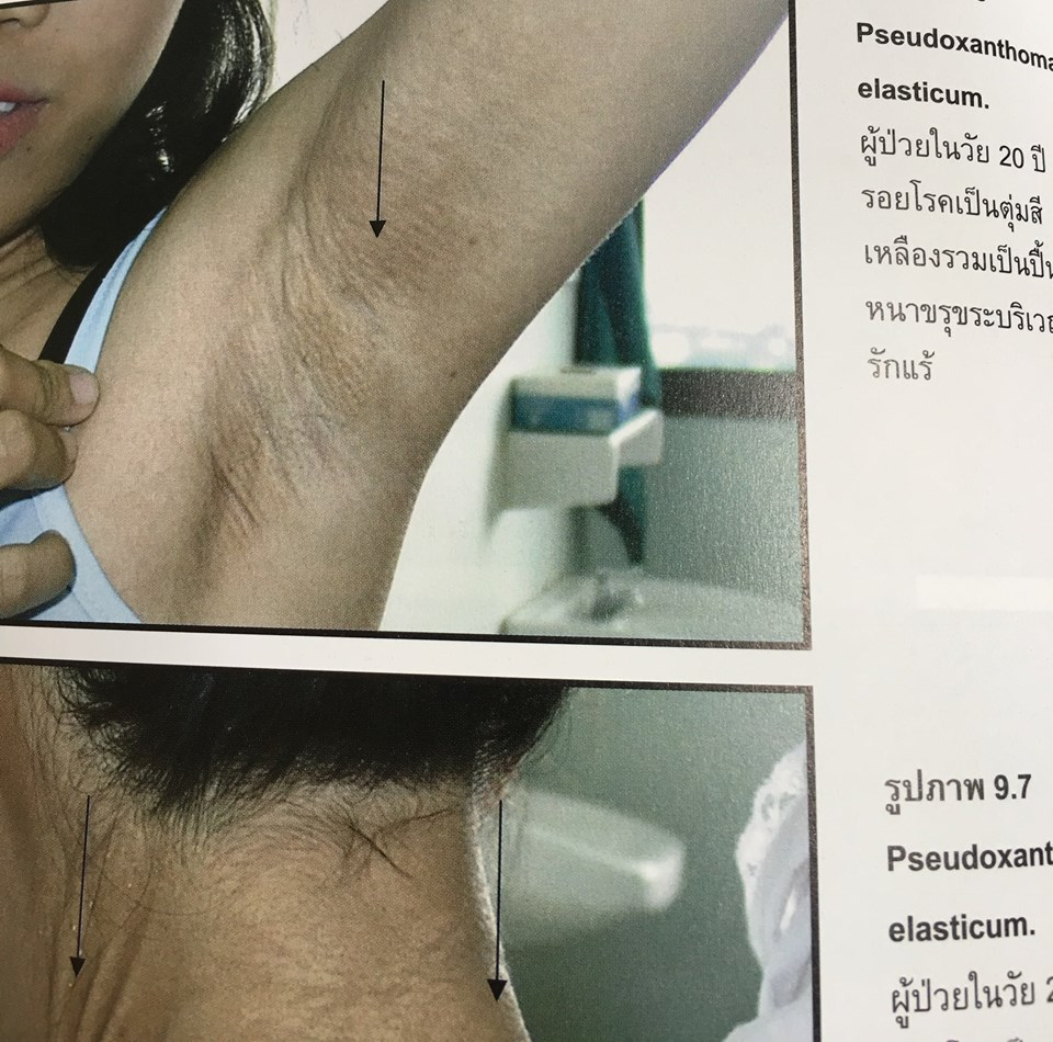 19958941_1737935306220878_5704245885415759245_n