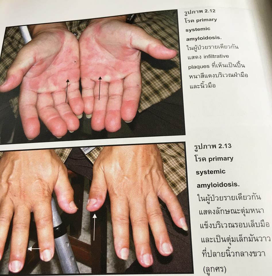 19959414_1737930329554709_7843341578409967028_n