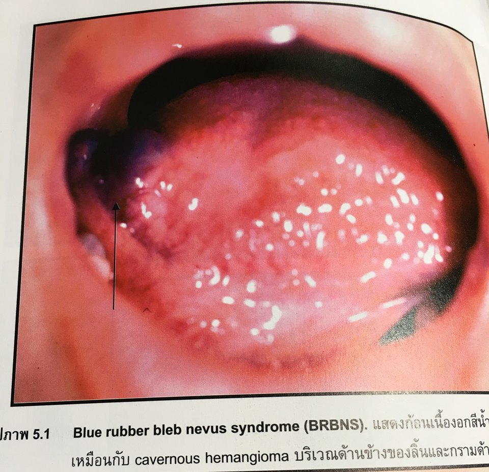 19961371_1737932386221170_1505681680458167003_n