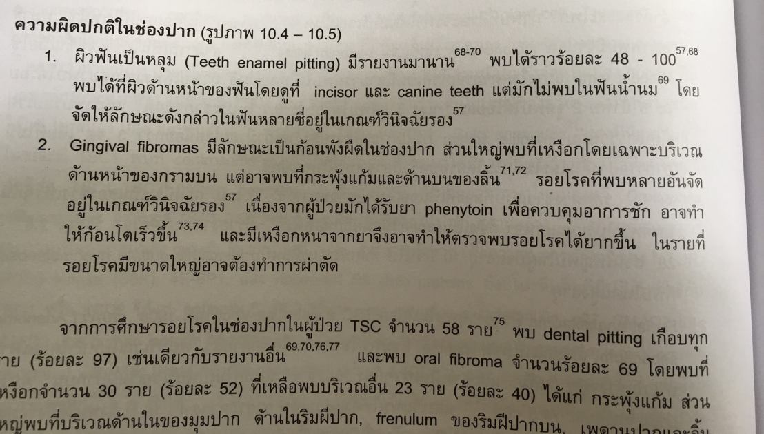 19983217_1737935479554194_313432793739483395_o