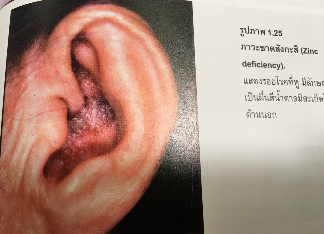 19983245_1737930049554737_973367035924550409_o