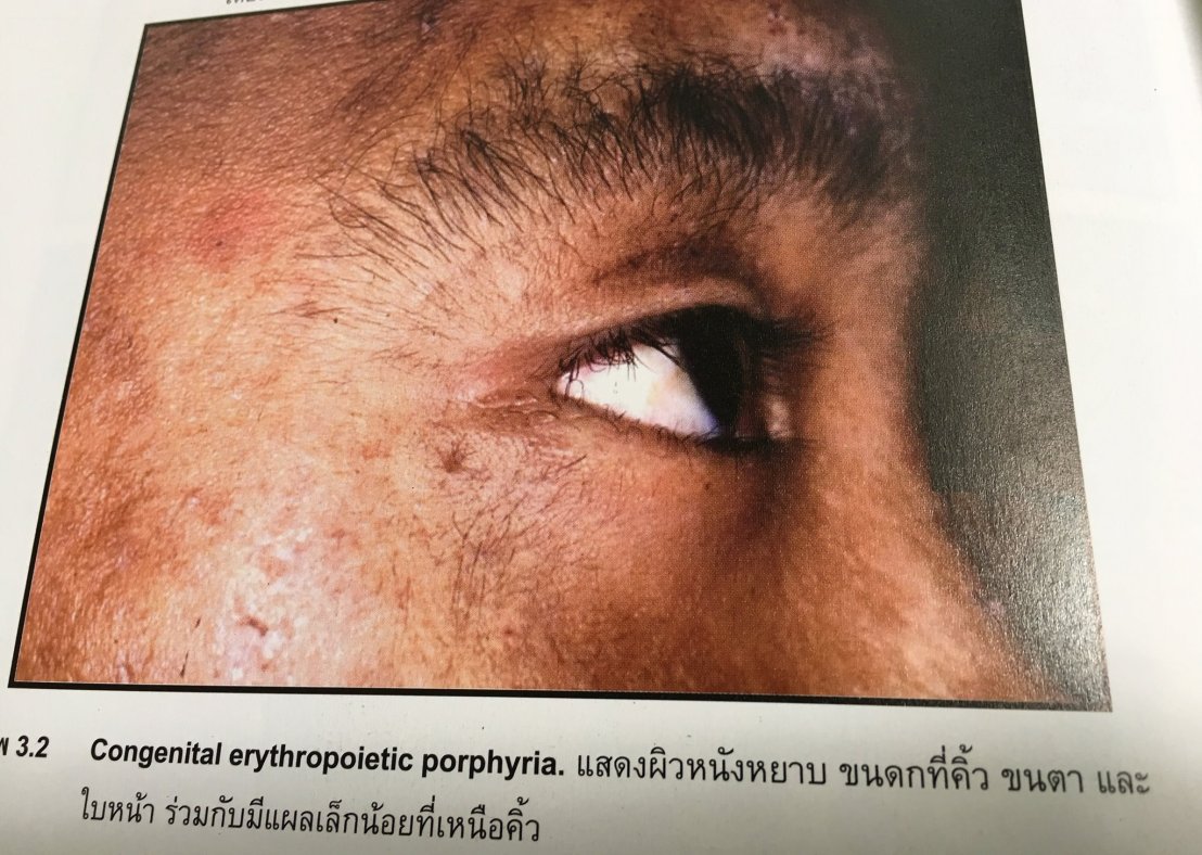 19983387_1737930992887976_1394837473437706932_o