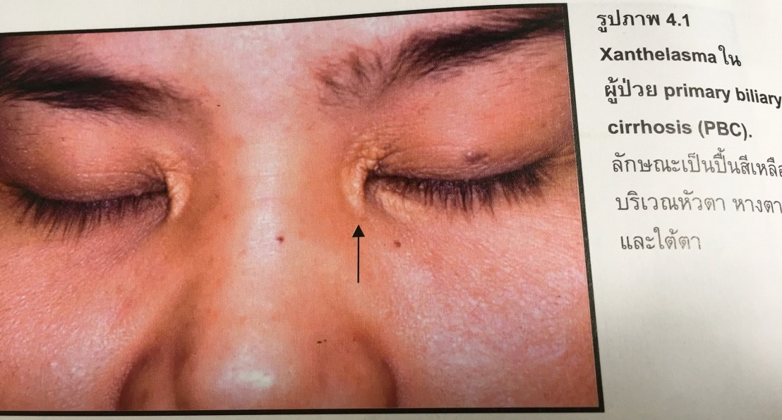 19983416_1737931559554586_7858218120571361890_o