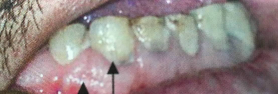 19983505_1737935776220831_7235852369112525210_o