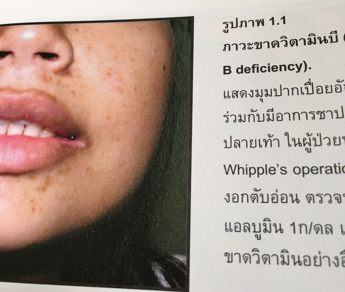 19983546_1737929569554785_6015600671088847367_o