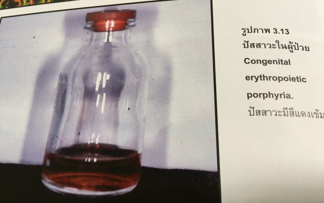 19983655_1737931312887944_4939882054230939671_o