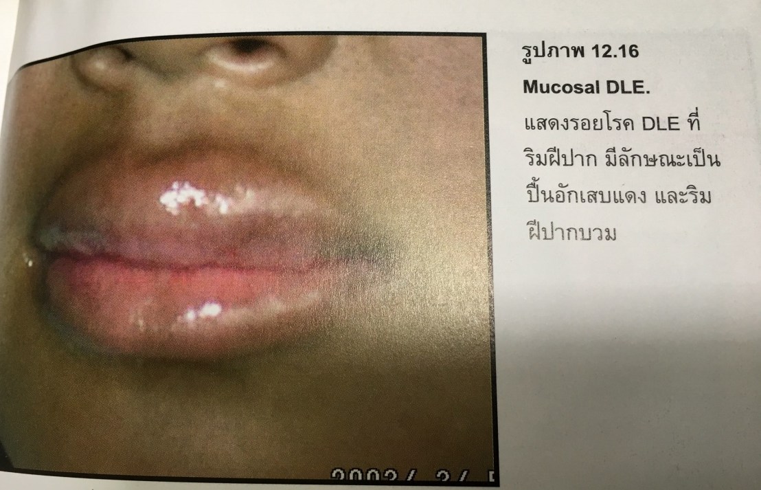 19983660_1737936319554110_1481615778660691071_o