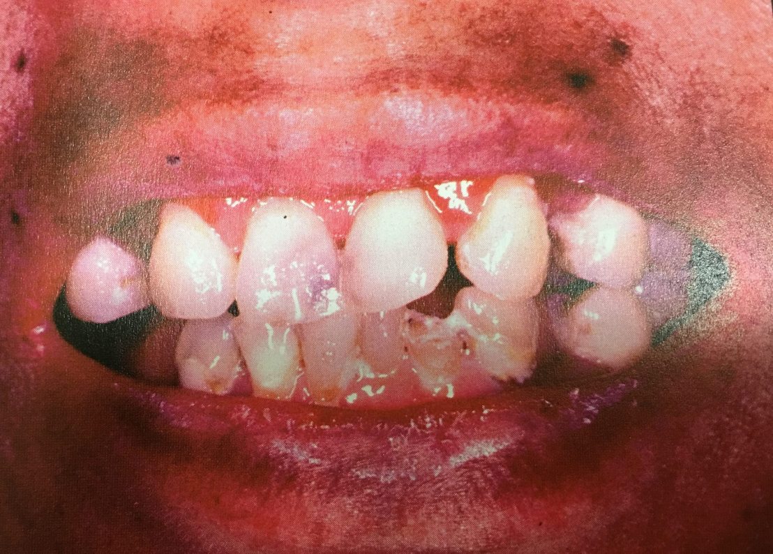 19983740_1737939032887172_6662332393311119406_o