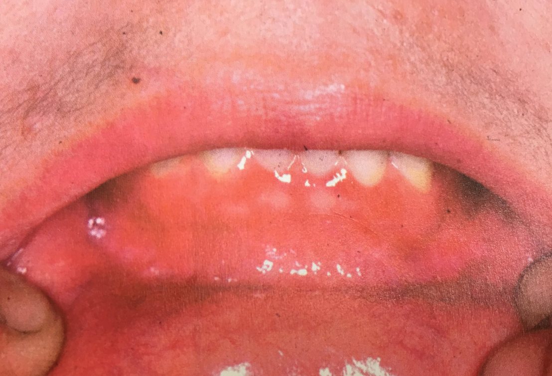 19983838_1737940332887042_8486440329049246110_o