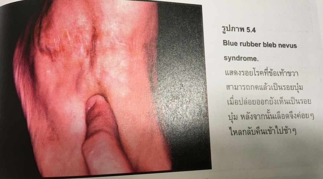 19983978_1737932546221154_3227040064572768468_o