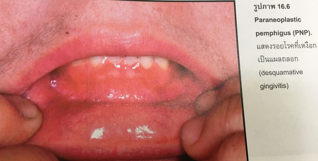 19983978_1737940252887050_8098594376795395420_o