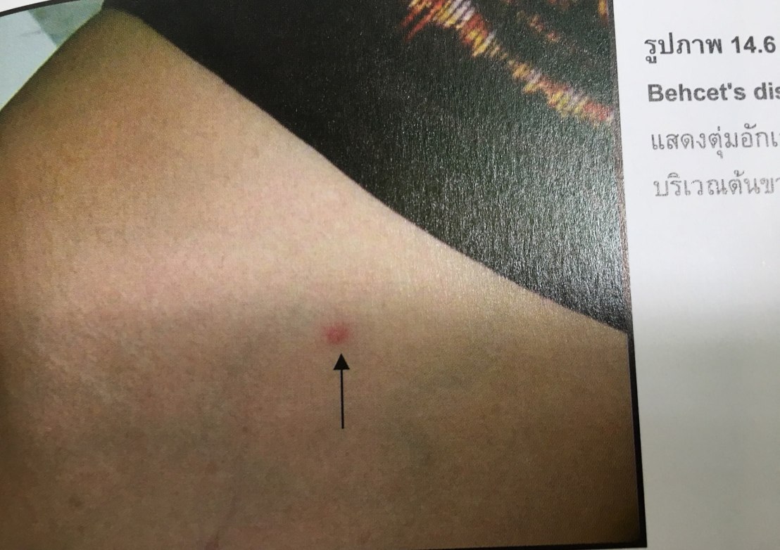 19984108_1737938116220597_3414749207453112640_o