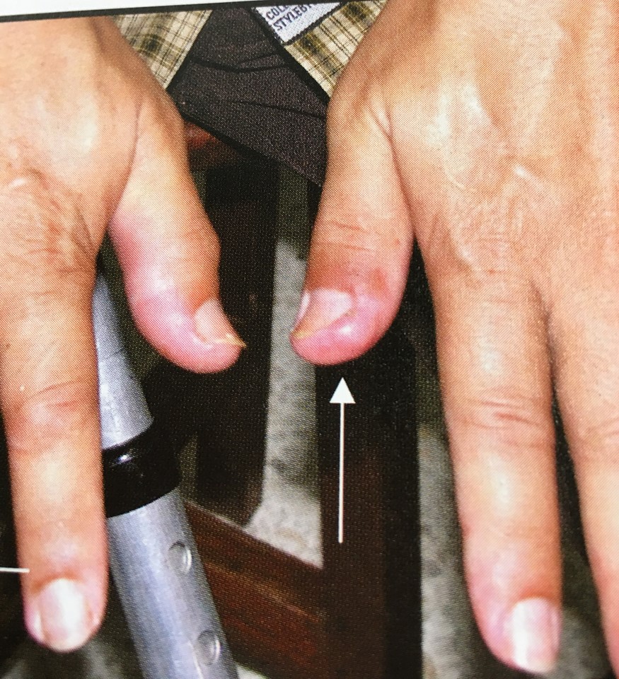 19989424_1737930409554701_1284674668357389368_n