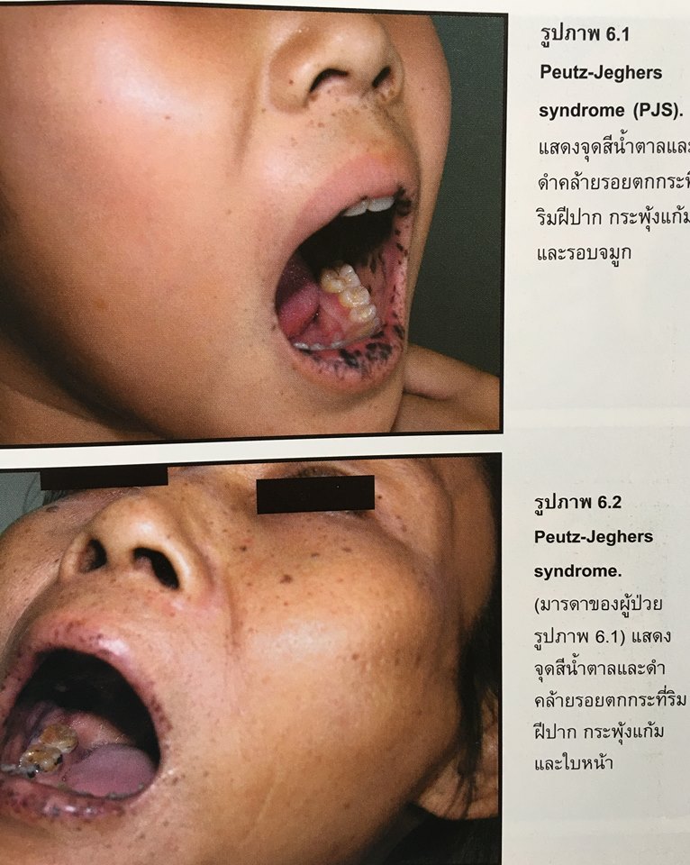 19990152_1737923472888728_4541278812923510177_n