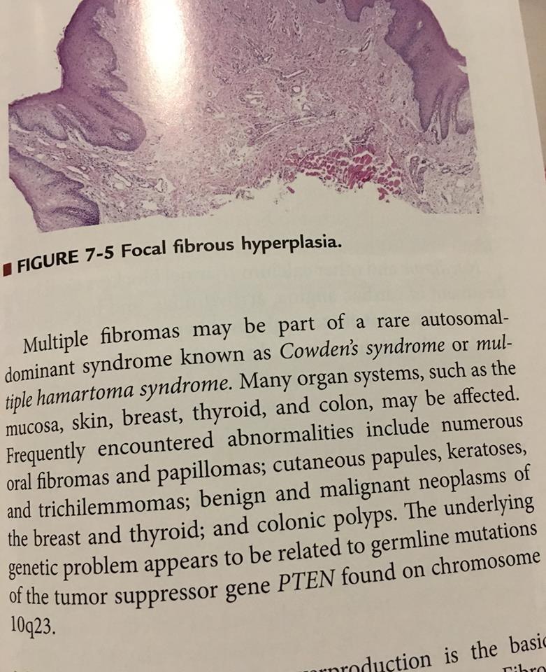 19990166_1738106079537134_541772380696019029_n