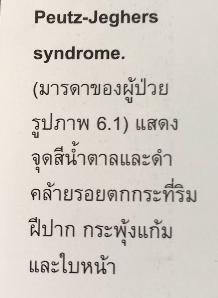 19990171_1737932976221111_51709984682039333_n