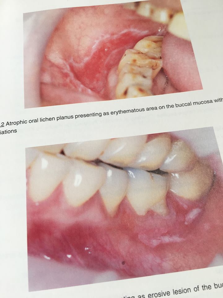 19990495_1737922886222120_7764861803767476348_n