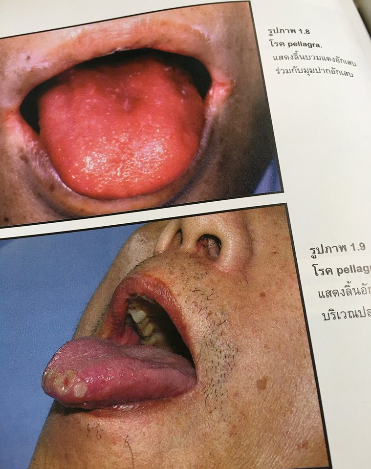 19990550_1737929832888092_3789845193137888568_n