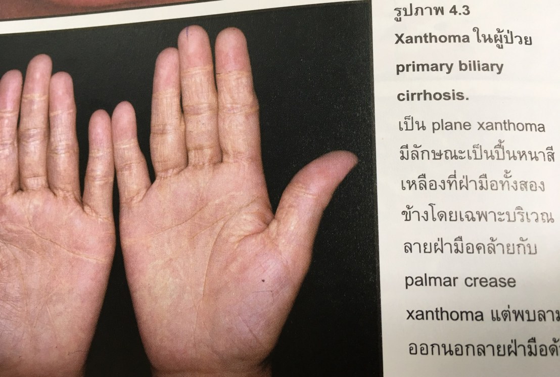 20017438_1737932016221207_2437432031534446066_o