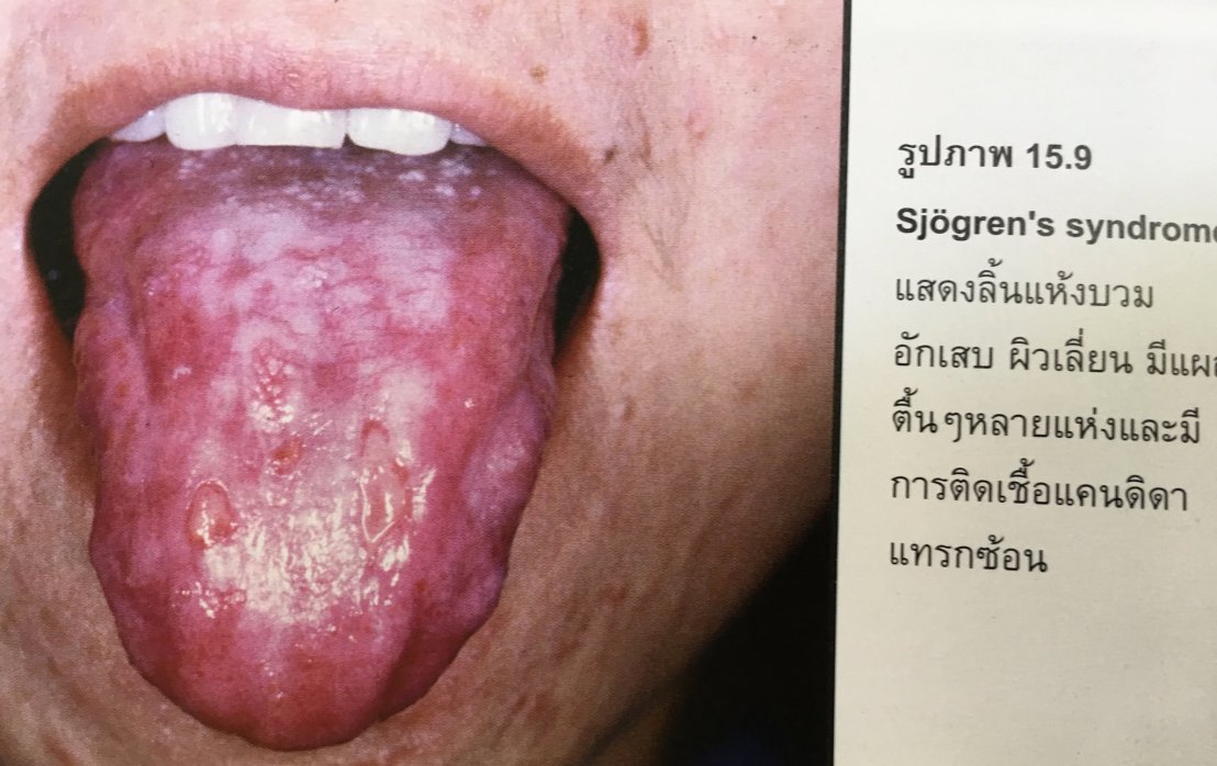 20017864_1737939739553768_8833033604774790978_o