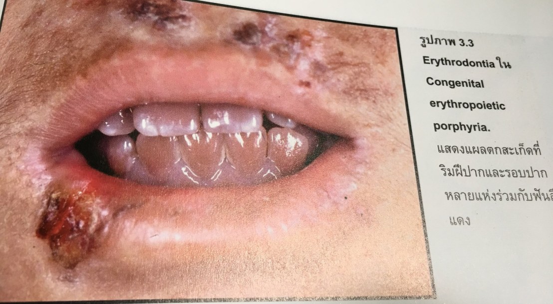 20017868_1737931129554629_4248395721883020117_o